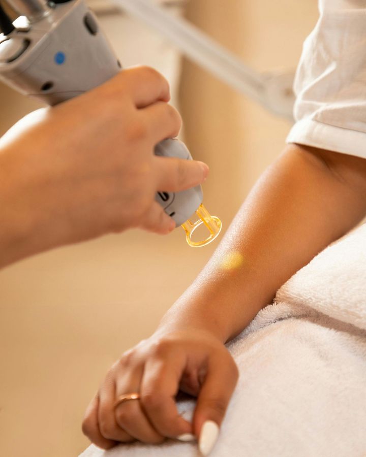 Una donna si sta sottoponendo a un trattamento laser sul braccio