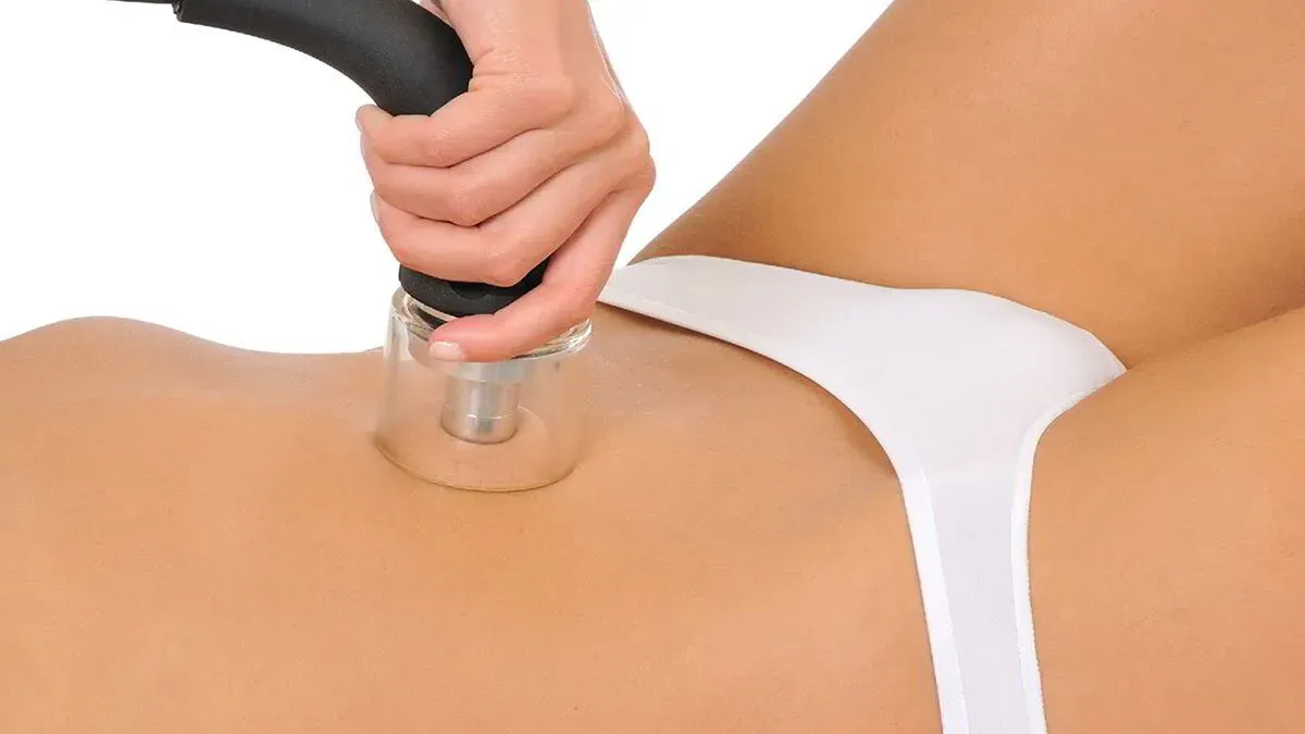 Durante un procedimiento de tratamiento cutáneo, una mano sostiene un dispositivo 