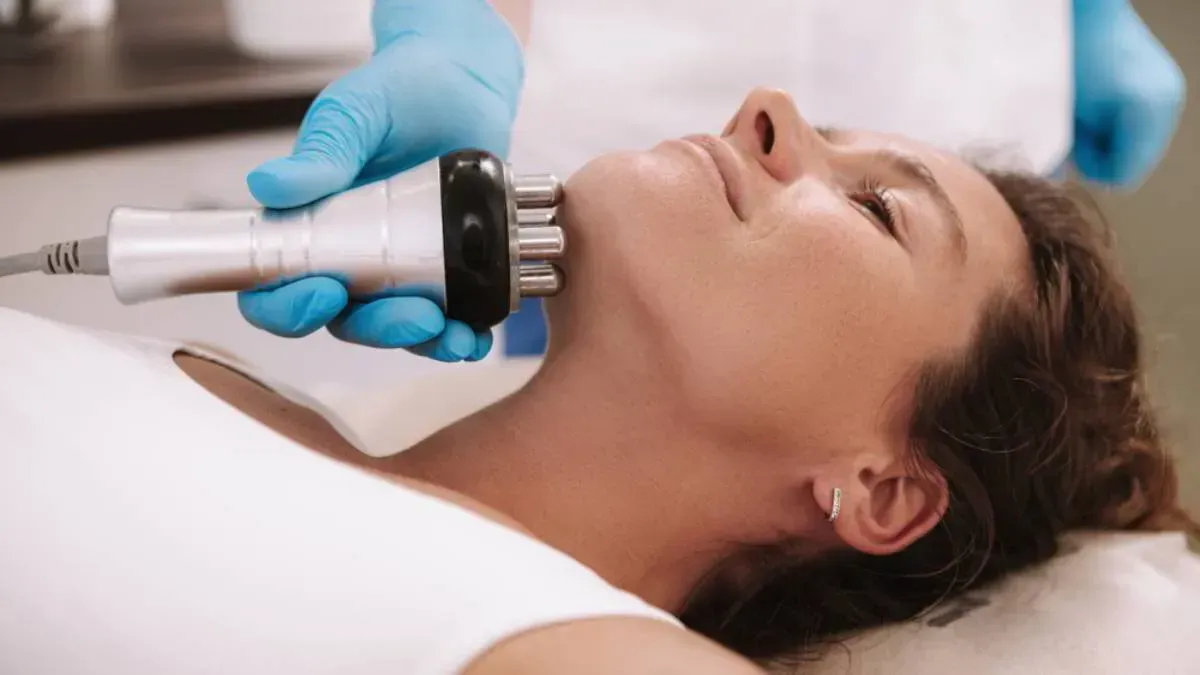 Una persona recibe un tratamiento de estiramiento facial por radiofrecuencia con una pieza de mano multipolar en una clínica.