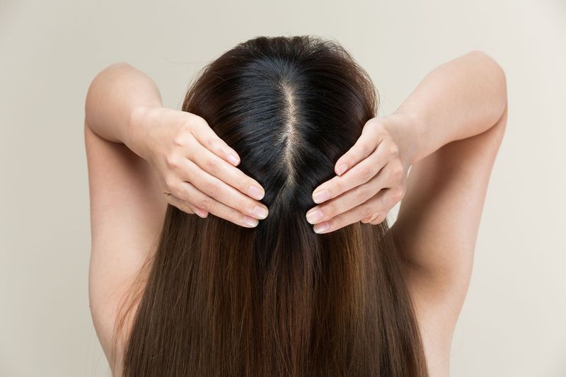 Une femme qui se plaque les cheveux sur le crâne avec des pellicules.