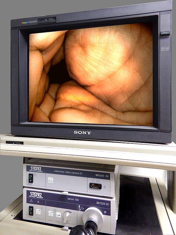 Endoskopie Monitor