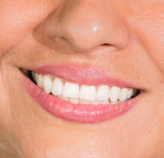 Mulher de cabelos curtos castanho-avermelhados deitada na grama.