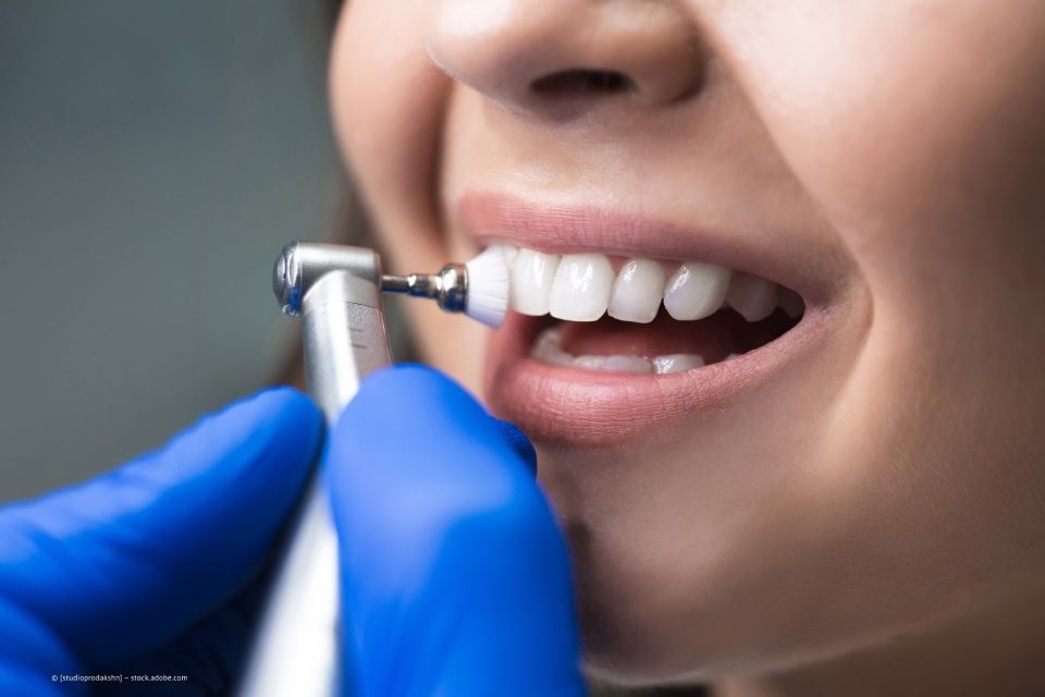 In der Praxis von Daniel Babel werden die Zähne einer Frau poliert