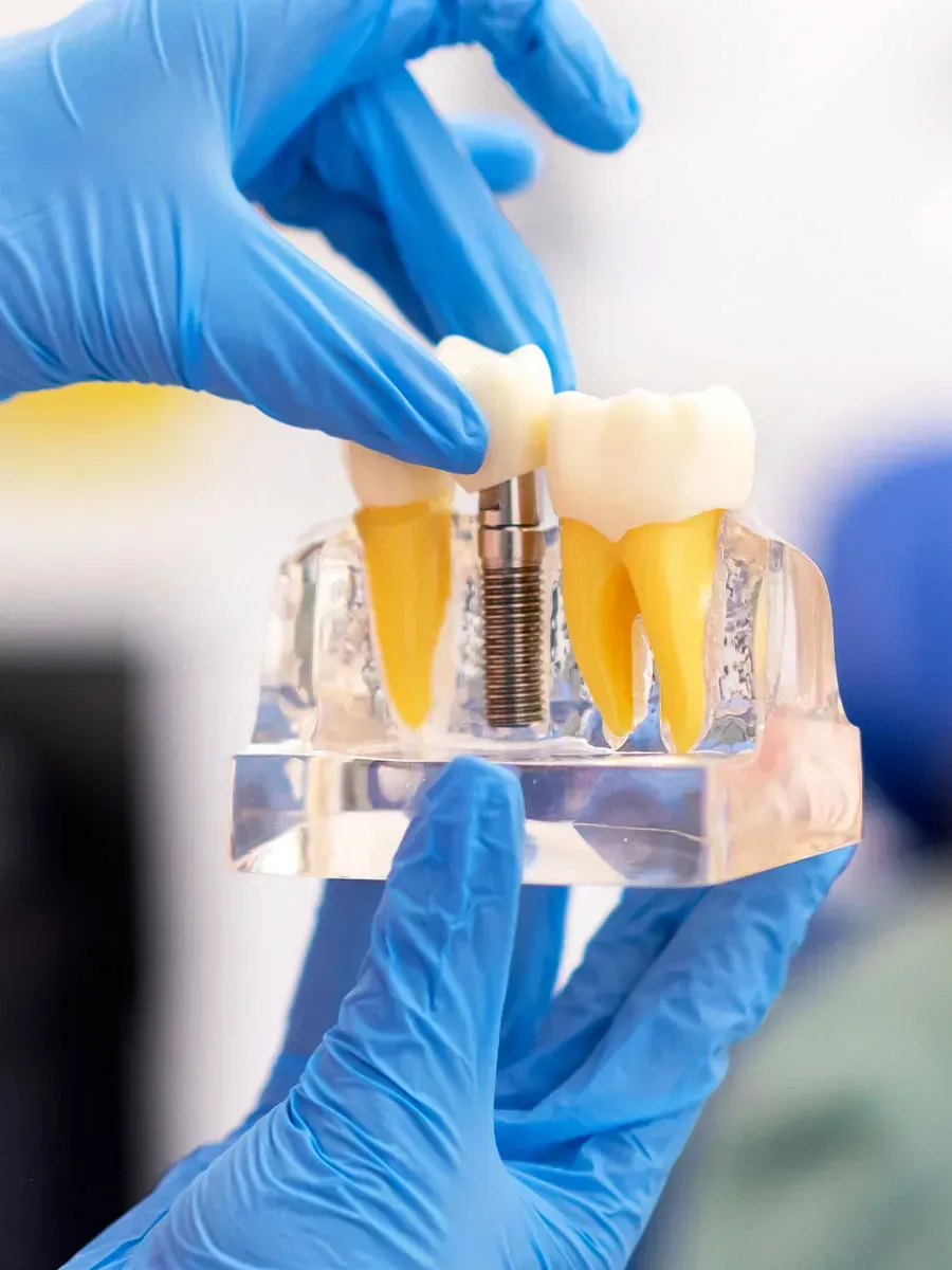 Una persona que lleva guantes azules sostiene un modelo de dientes.