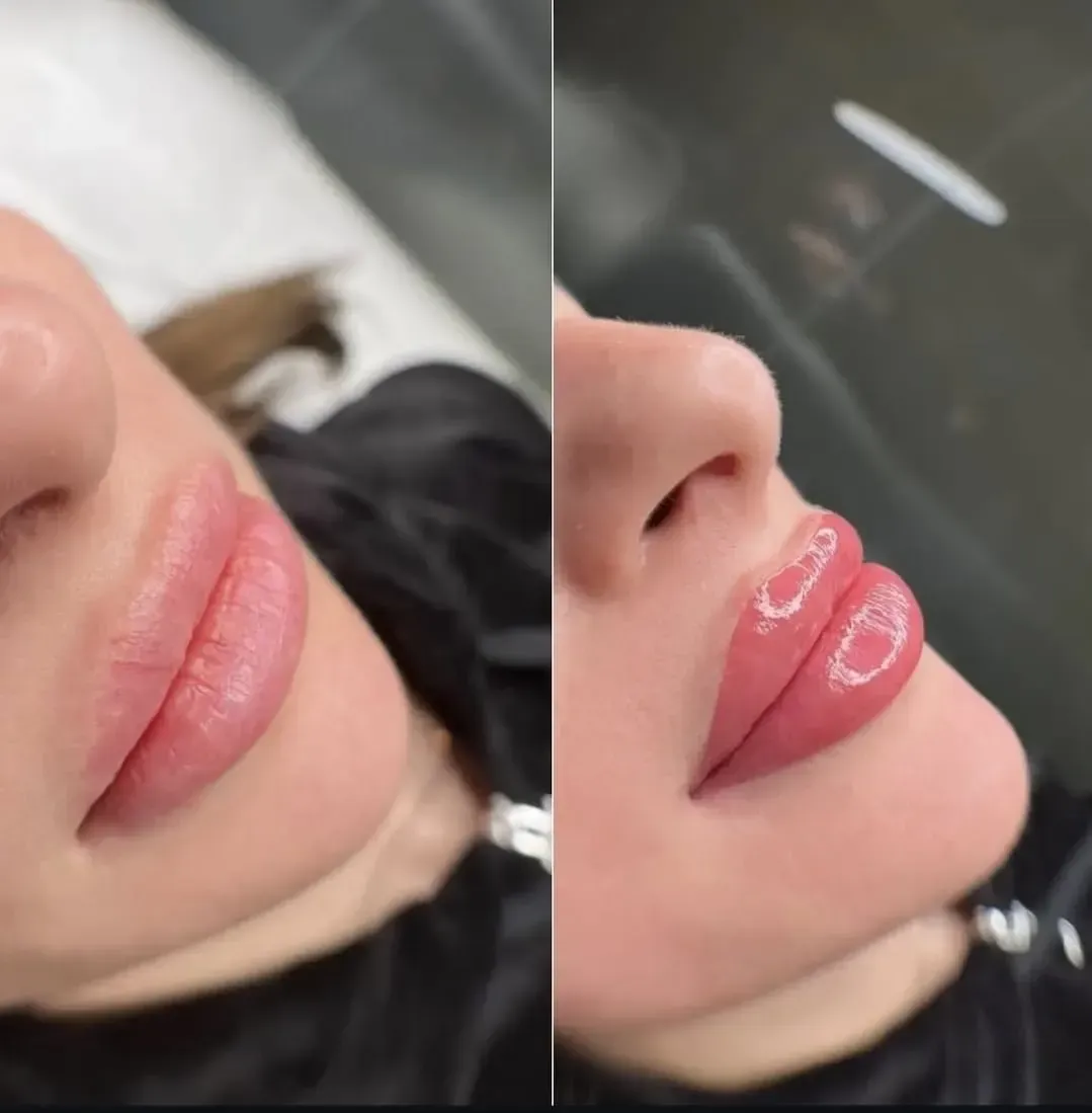 Primer plano de labios rosados brillantes, mostrados en una comparación lado a lado del antes y el después.