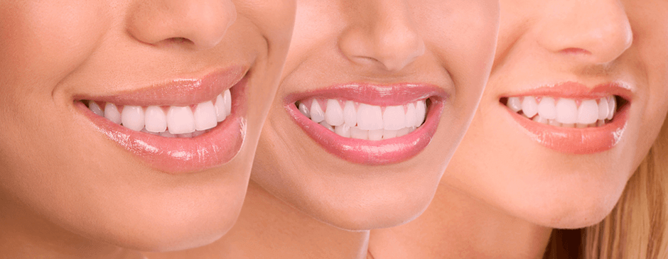 Estética Dentária New Clinic