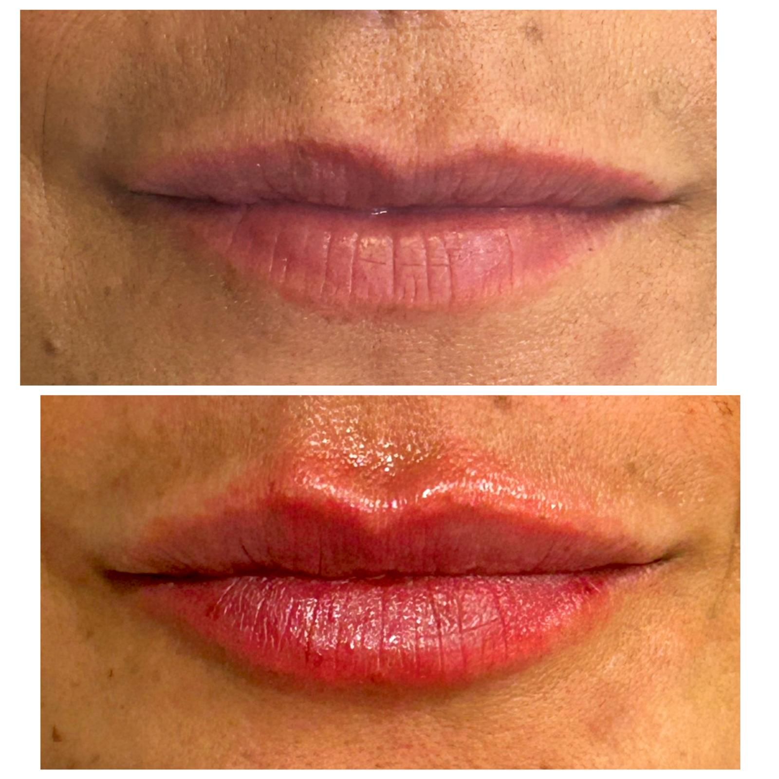 Persona que recibe un tratamiento de contorno corporal con un dispositivo portátil en la pierna en una clínica.