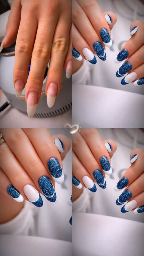 Manos con manicura francesa con purpurina azul, antes y después. Puntas blancas con detalles plateados.
