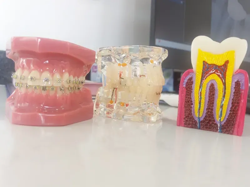 Three models of teeth are sitting on a table.