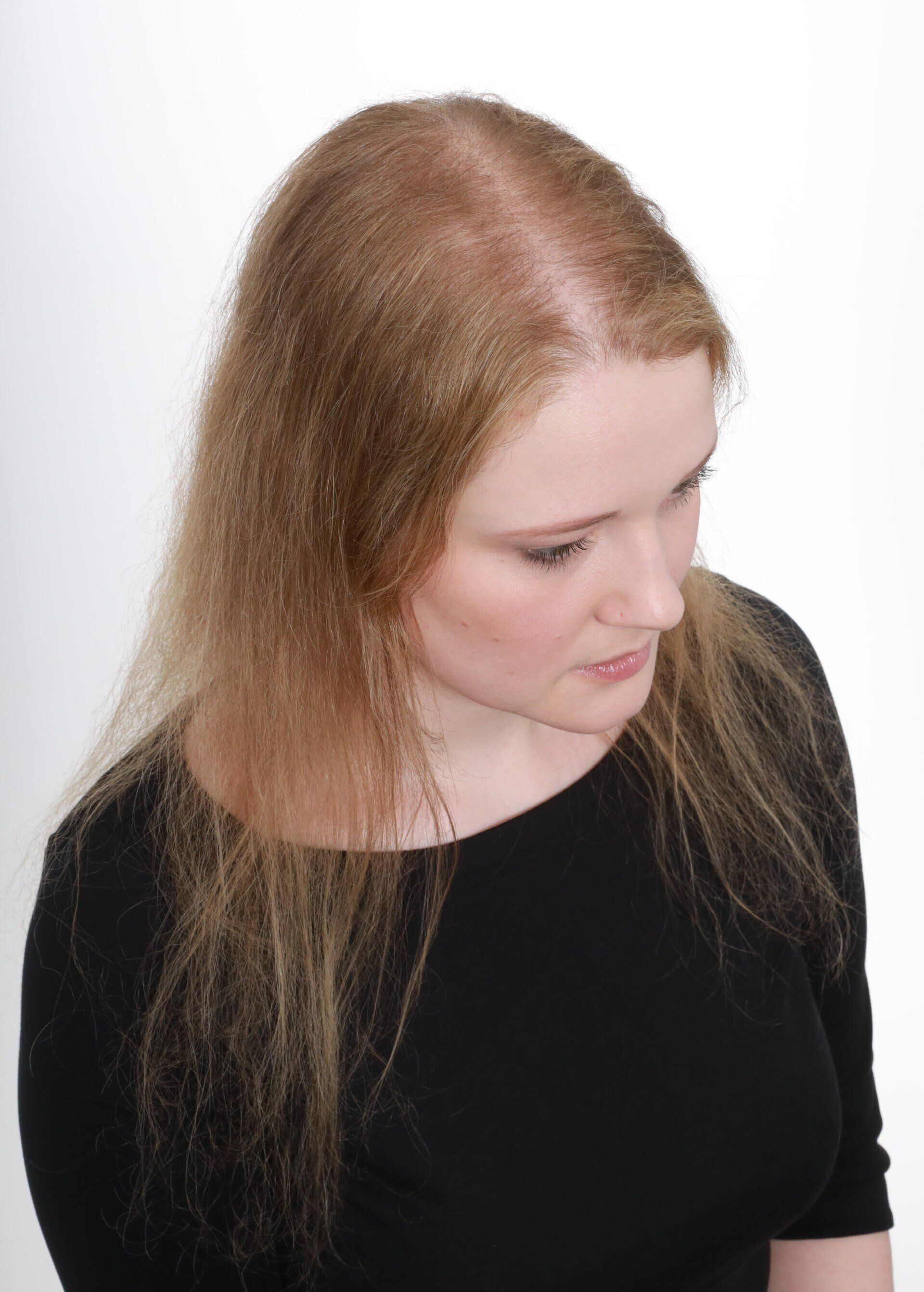 Friseur am Kuhsee – Frau beim Friseur