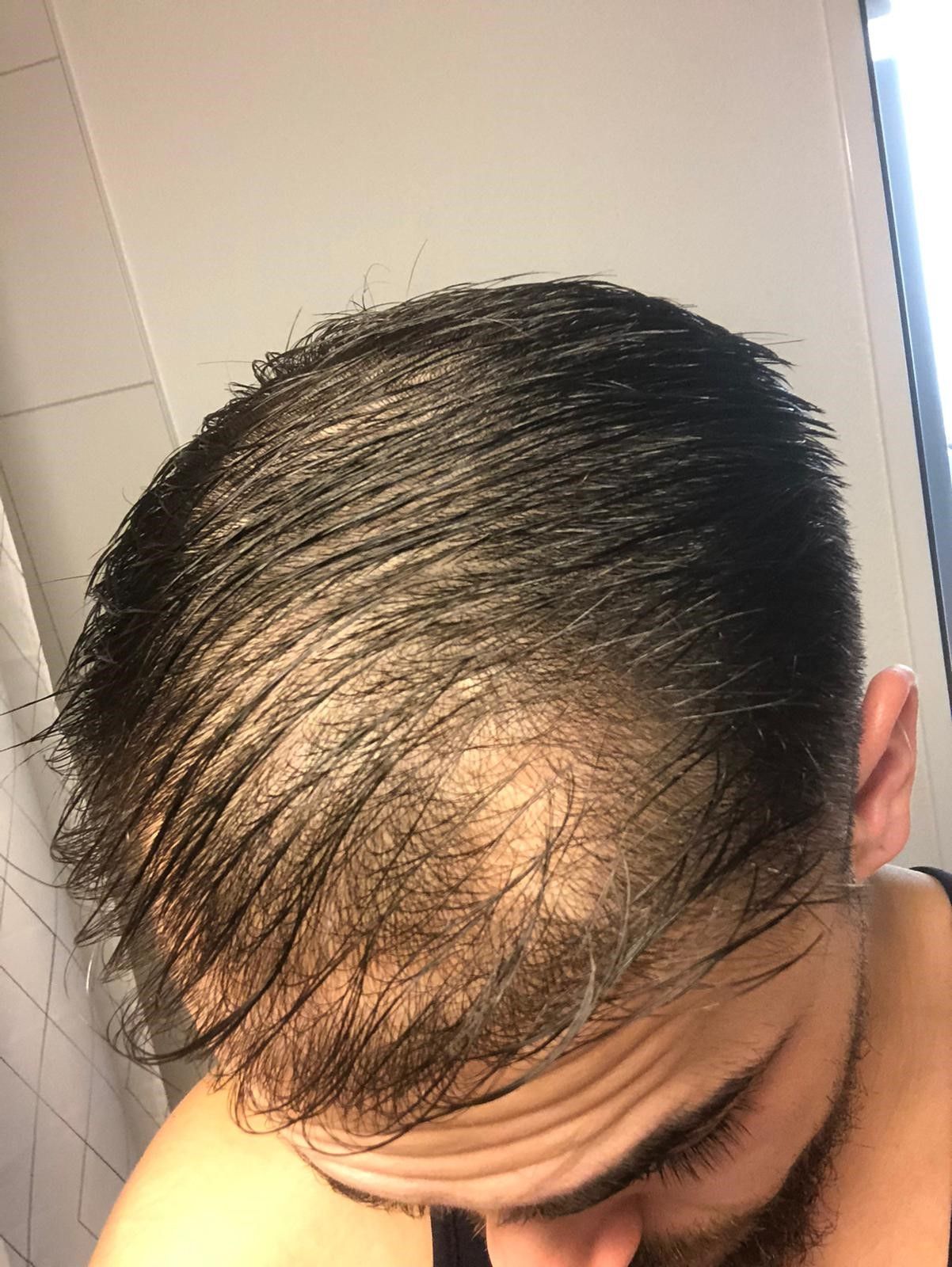 HAIR CARE BK
