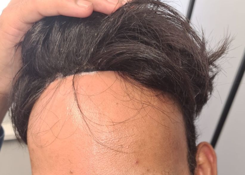 HAIR CARE BK