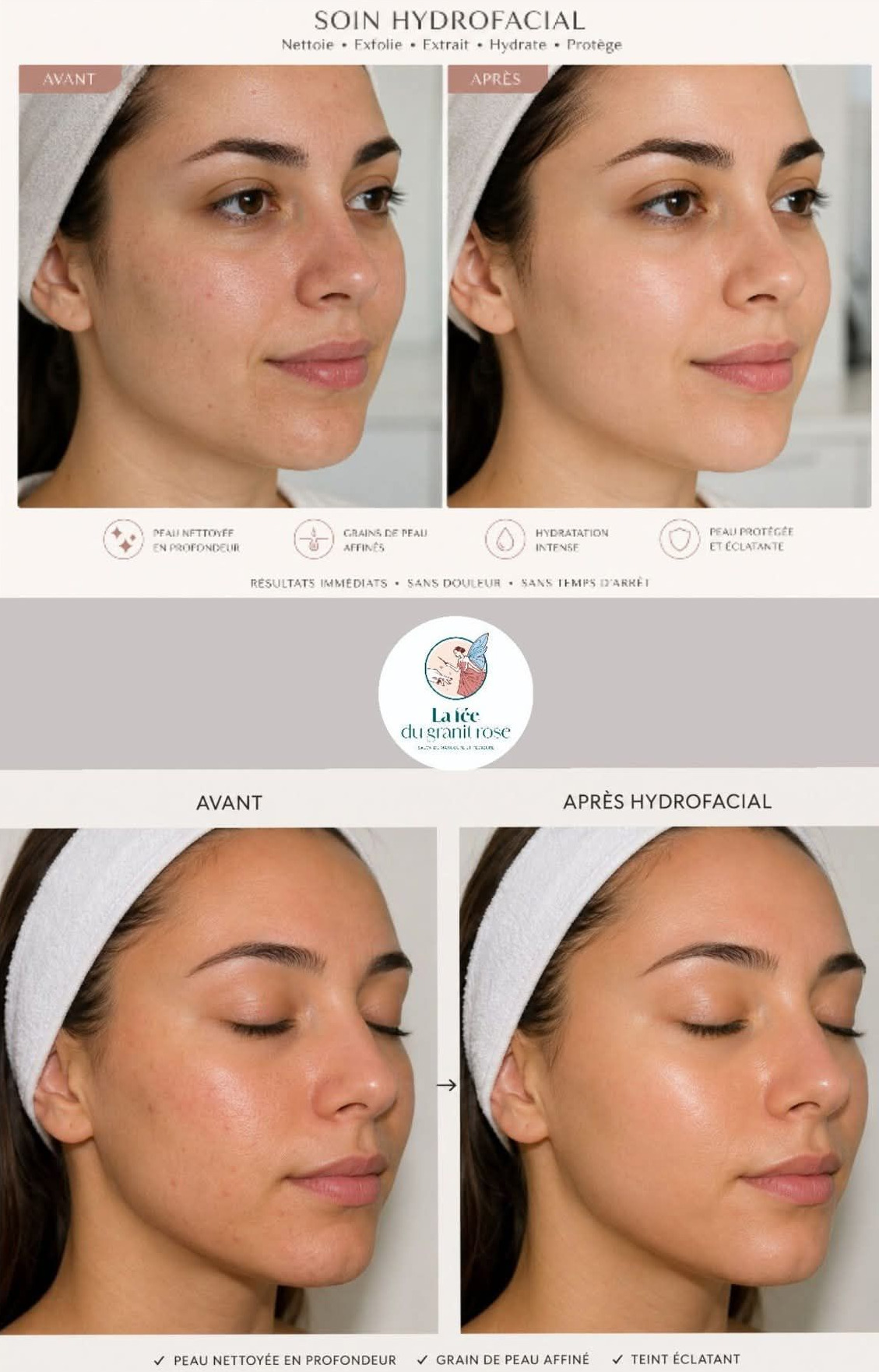 Soin Hydrofacial en institut, avant après