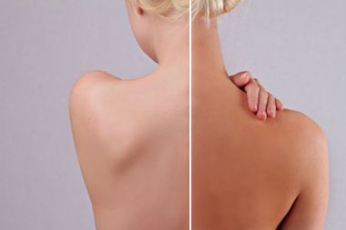 Comparaison dos à dos : Une version avec la peau claire, l’autre après une séance de bronzage.
