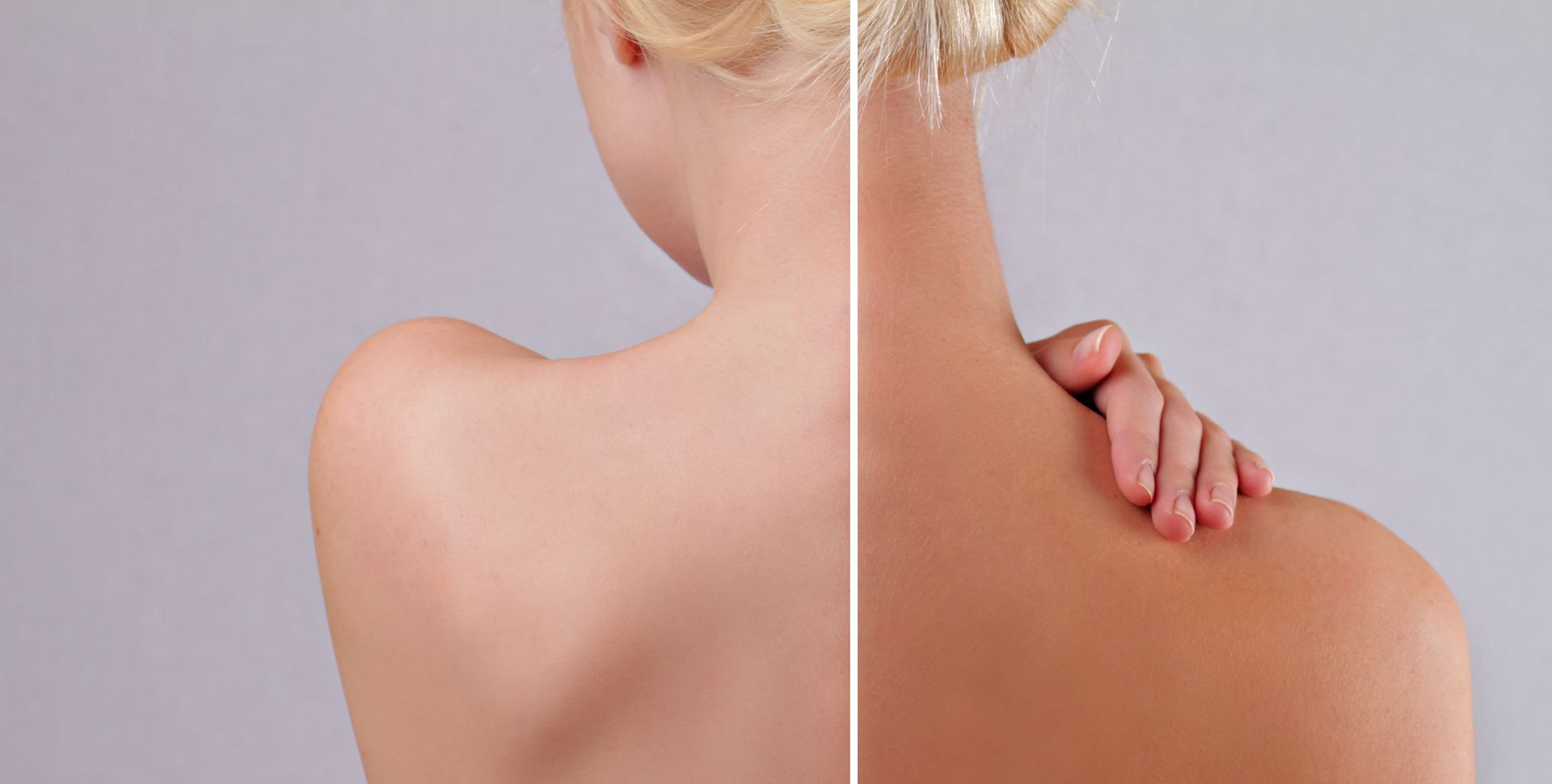 Image divisée montrant un dos nu avec peau claire à gauche et peau bronzée à droite.