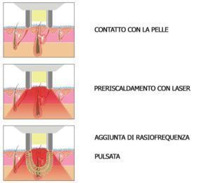 Come funziona la cura delle macchie pigmentate - M. W. Medicina Estetica
