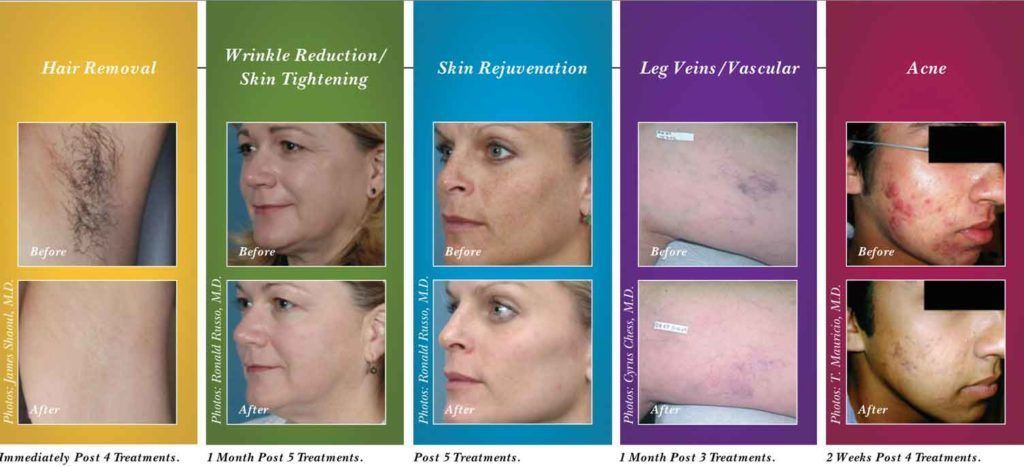 Macchie pigmentate sul viso - M. W. Medicina Estetica