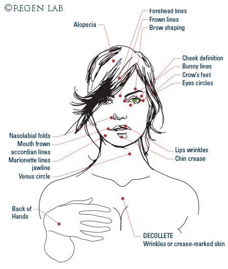 Trattamento anti-età viso e corpo - M. W. Medicina Estetica
