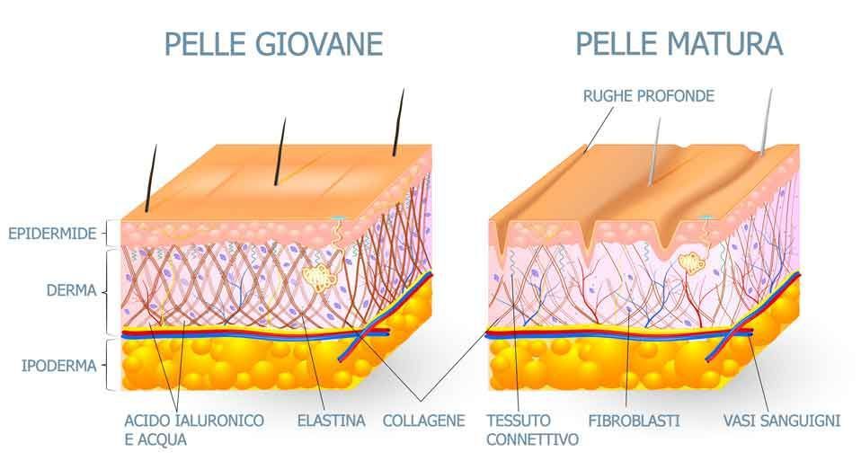 Trattamento anti-età contro le rughe - M. W. Medicina Estetica