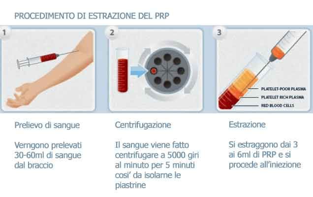 Come funziona il trattamento anti-età - M. W. Medicina Estetica
