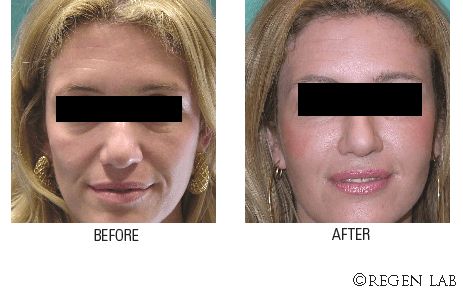 Trattamento anti-età viso donna - M. W. Medicina Estetica