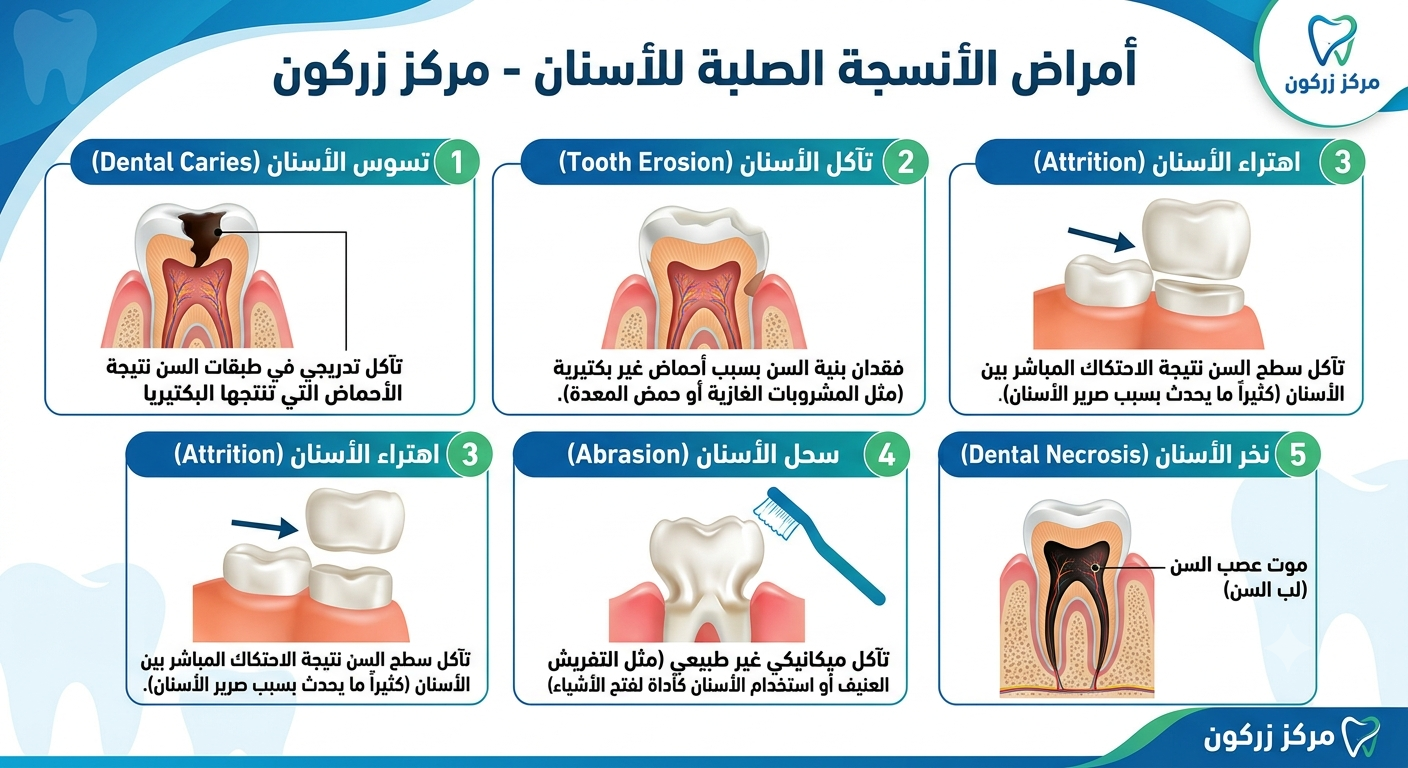 علاج تسوس وتآكل الأنسجة الصلبة للأسنان بالزركون
