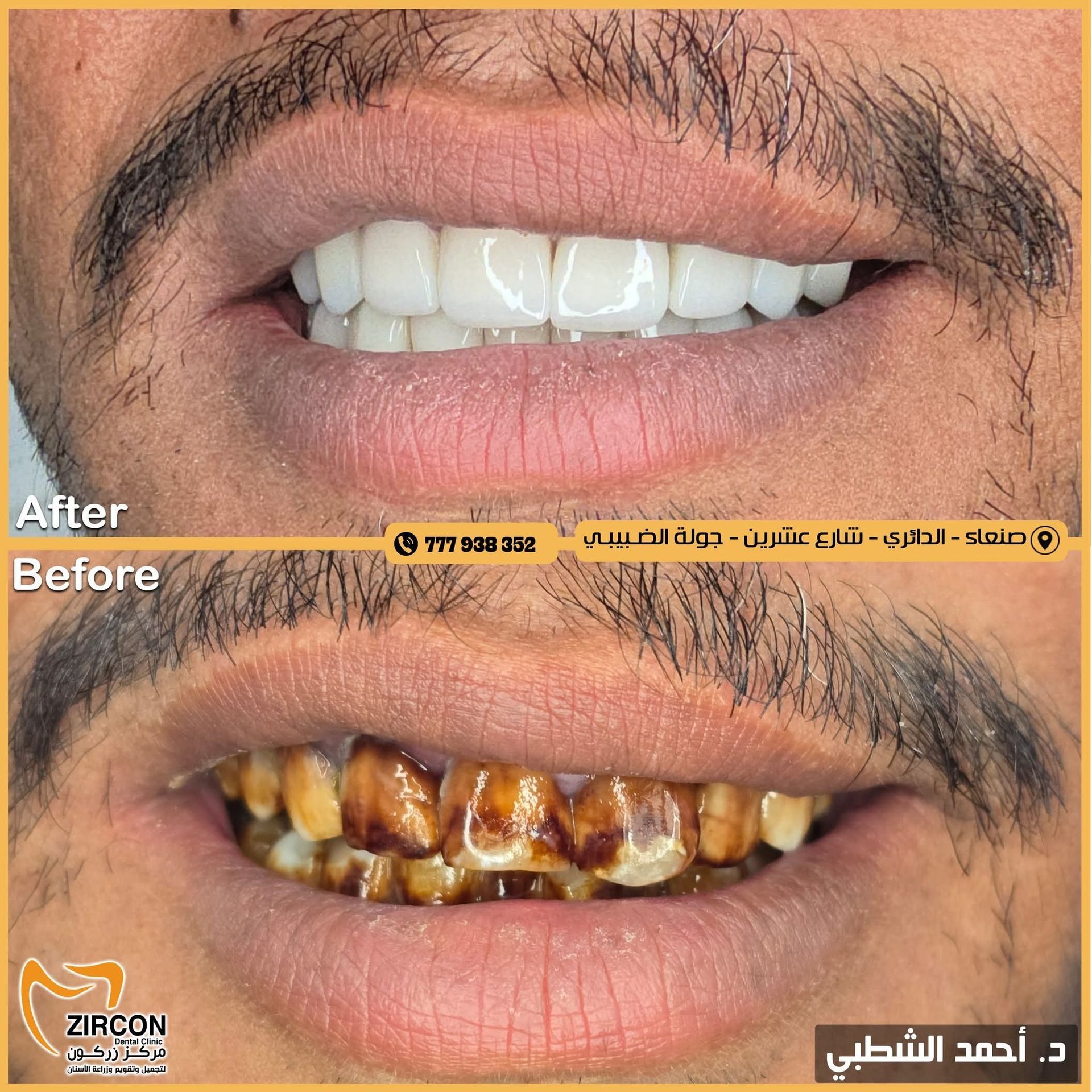 عرض حالة