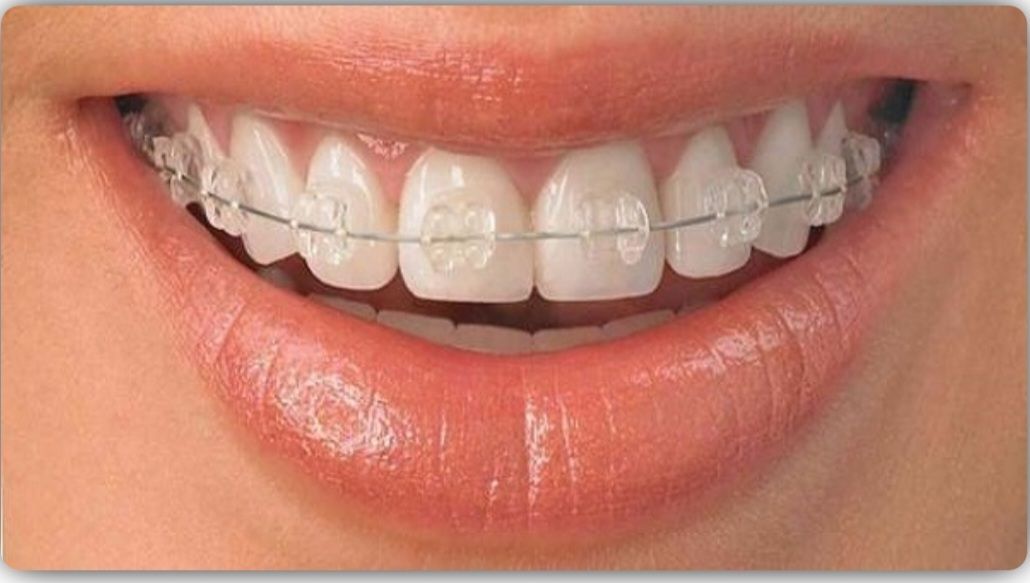 التقويم الشفاف