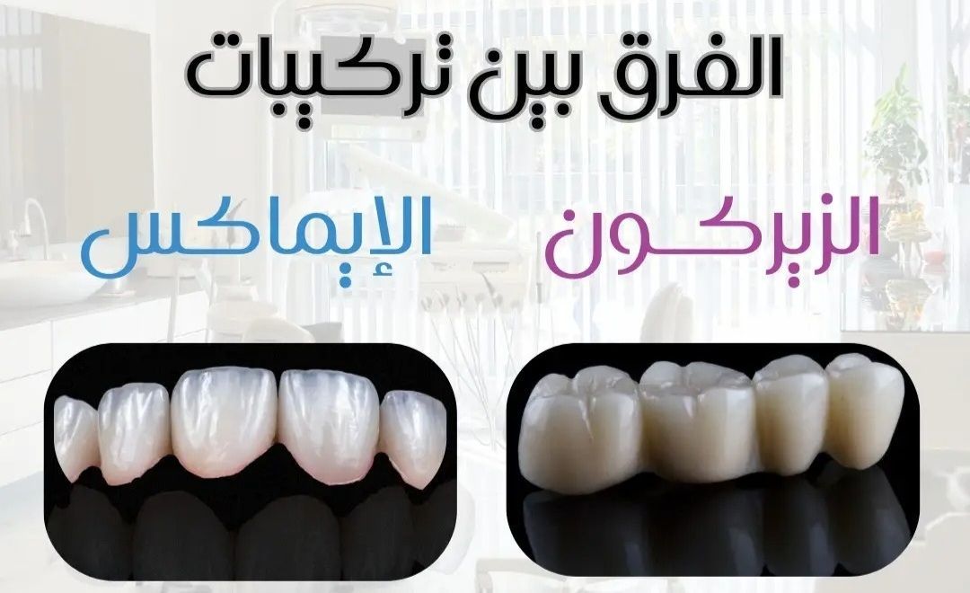 مقارنة بين تيجان الزيركون وإيماكس