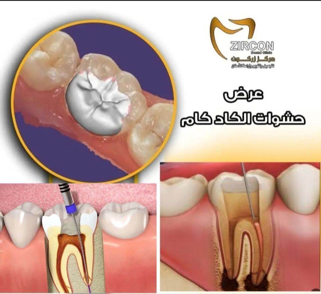 آلة خرط خماسية المحاور في مركز زركون