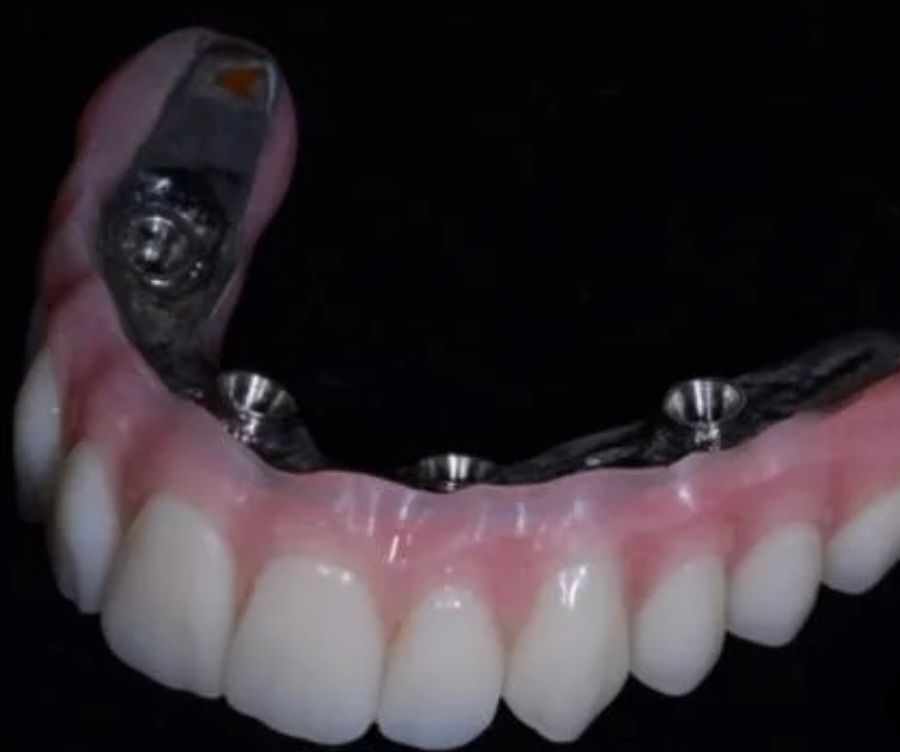 طقم الأكريل