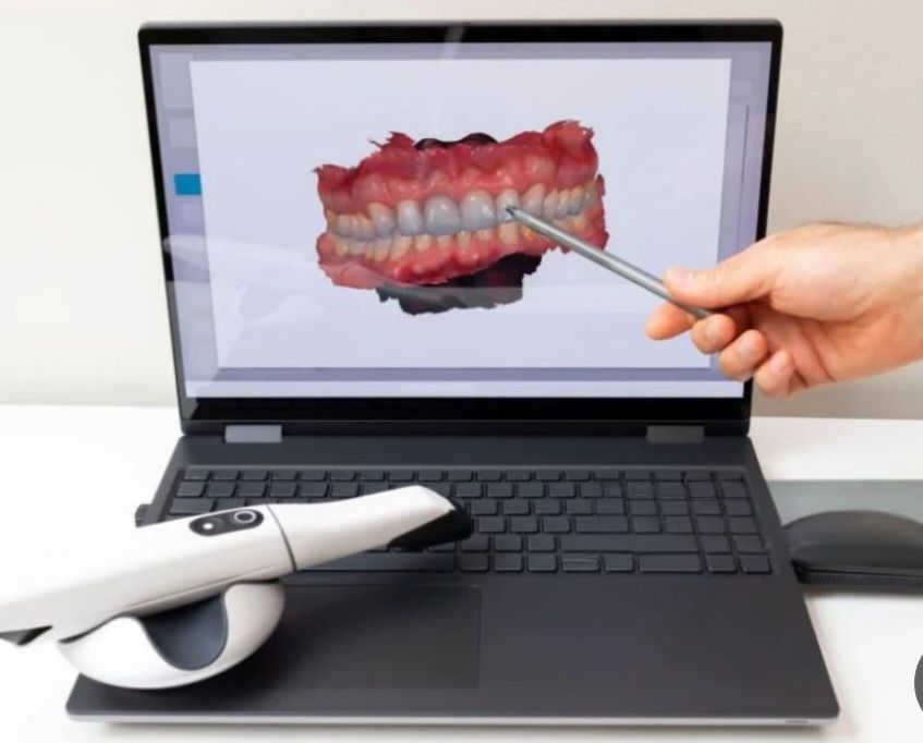 اطقم الاسنان