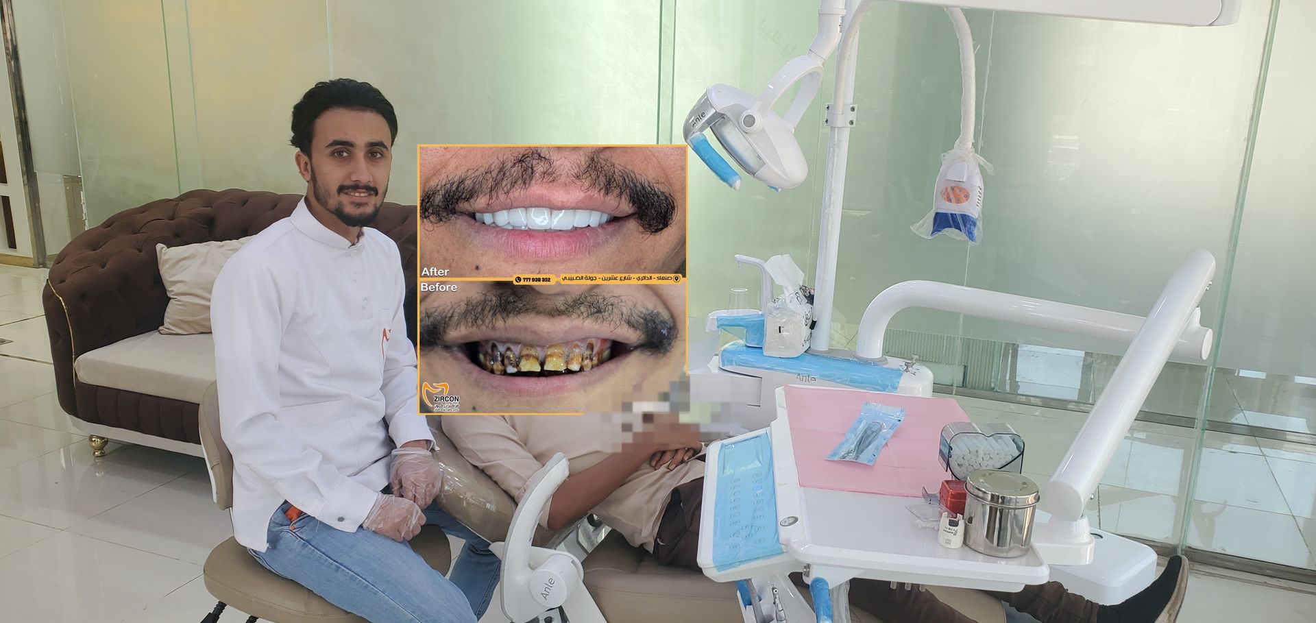 تلبيسات الزركون والبورسلين