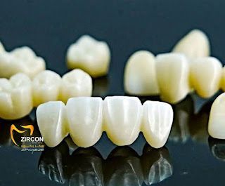 مميزات الزركون