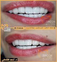 مركز زركون لطب الأسنان