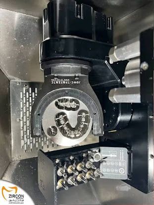 نتائج العلاج