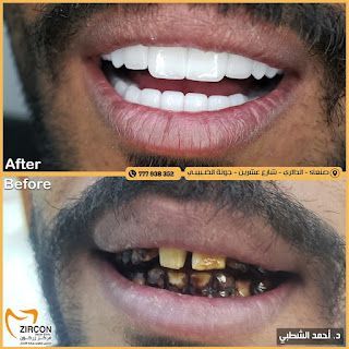 صورة قبل المعالجة