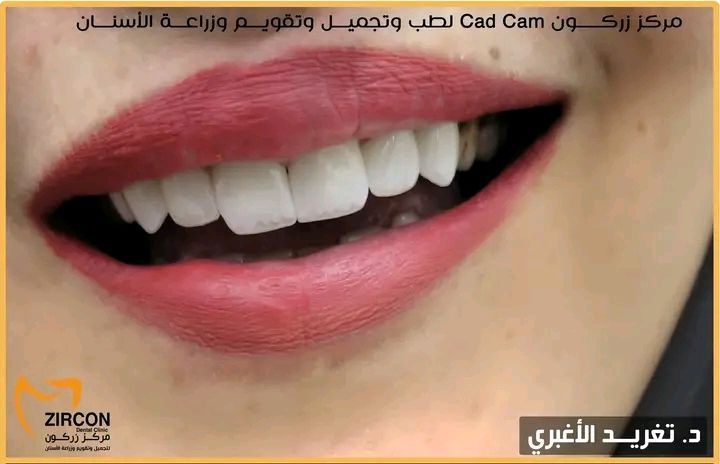 ابتسامة راقية