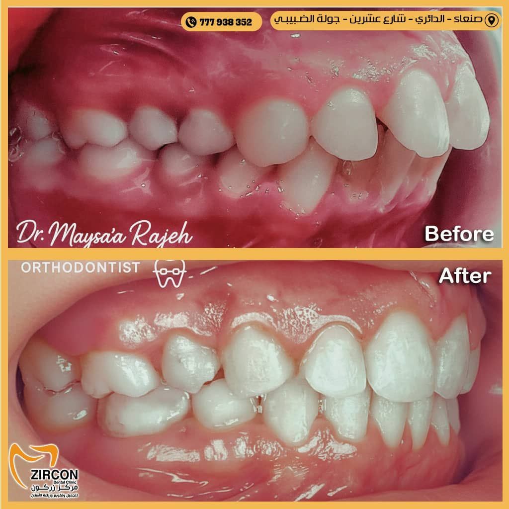 واجهة مركز زركون