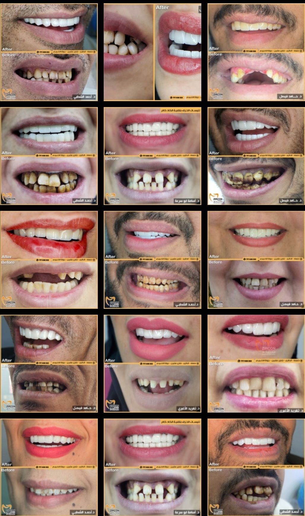 لقطة من داخل مركز زركون