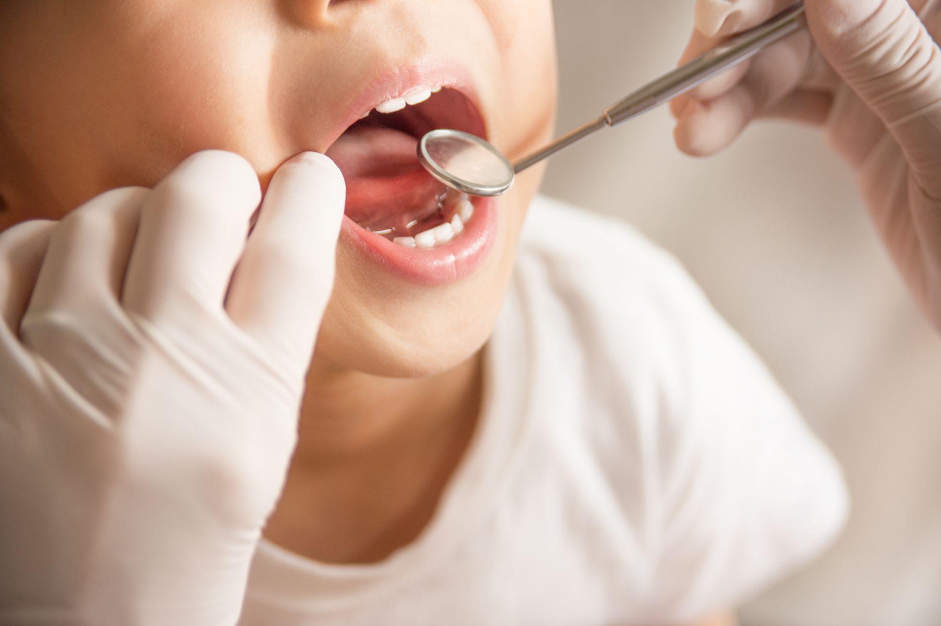 Un dentiste examine la bouche ouverte d'un enfant à l'aide d'un miroir dentaire, les mains gantées.