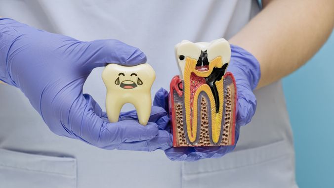 Des mains gantées tiennent un modèle de dent et une coupe transversale d'un canal radiculaire.