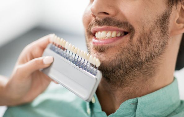 Une main tenant un nuancier dentaire près d'une bouche souriante d'une personne.