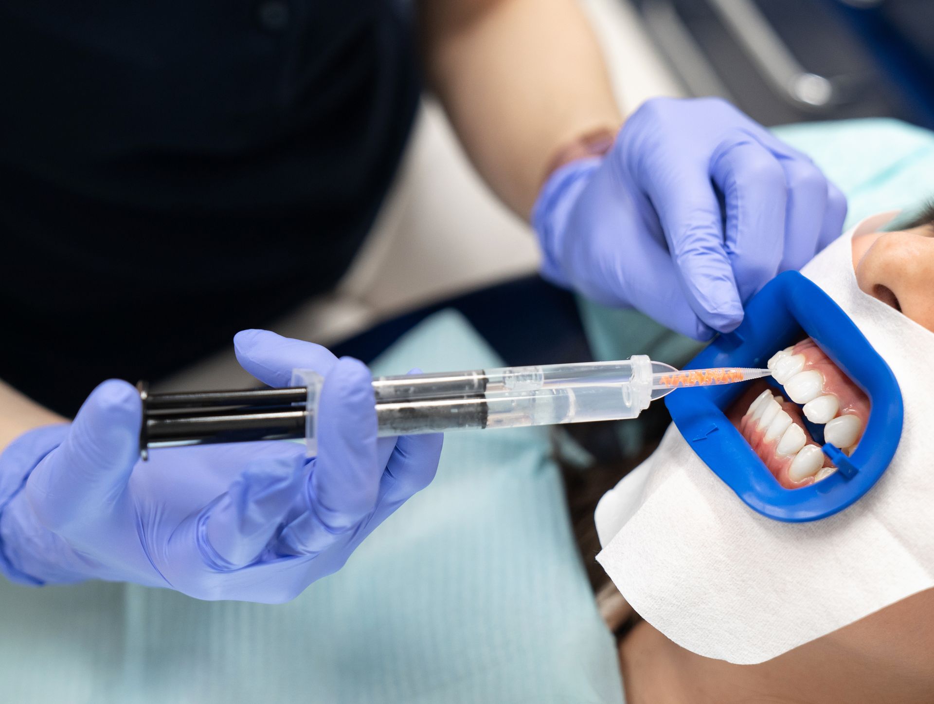 Un dentiste injecte un anesthésiant dans la gencive d'un patient avec des mains gantées de bleu.