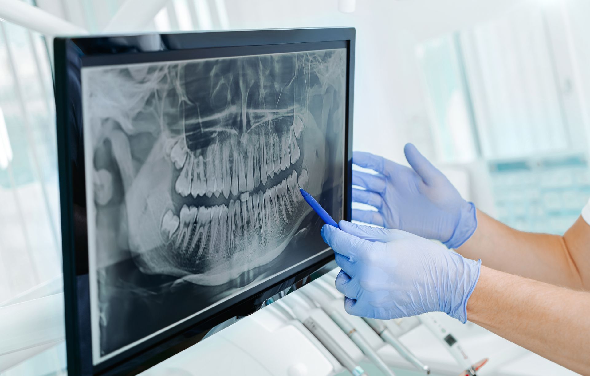 Un dentiste portant des gants bleus montre une radiographie dentaire sur un écran.