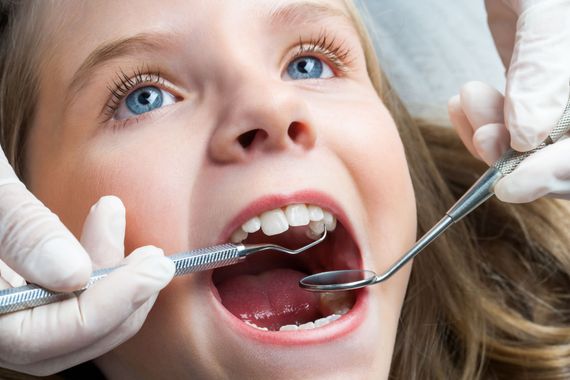 Enfant chez le dentiste, la bouche ouverte, tandis que des mains gantées manipulent les instruments dentaires lors d'un examen.