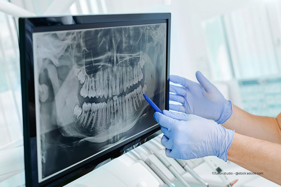 Zahnärztin der Zahnarztpraxis Hartmann betrachtet ein Röntgenbild