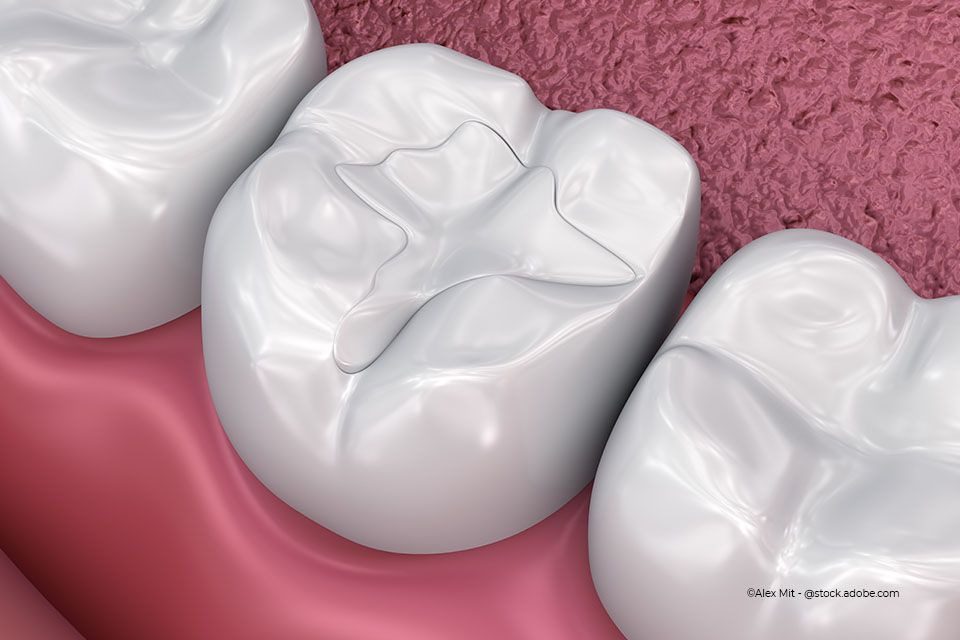 In der Zahnarztpraxis Hartmann werden die Zähne einer Patientin gebleicht