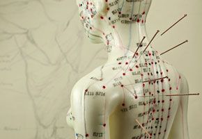 Acupuncture