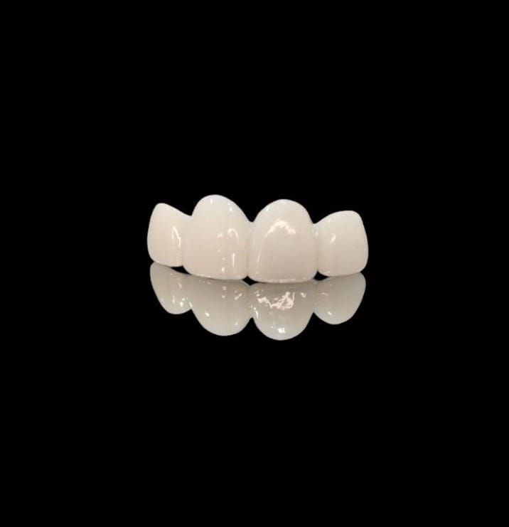 Puente dental, dientes de porcelana blanca sobre fondo negro.